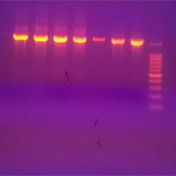 PCR based Gene amplification