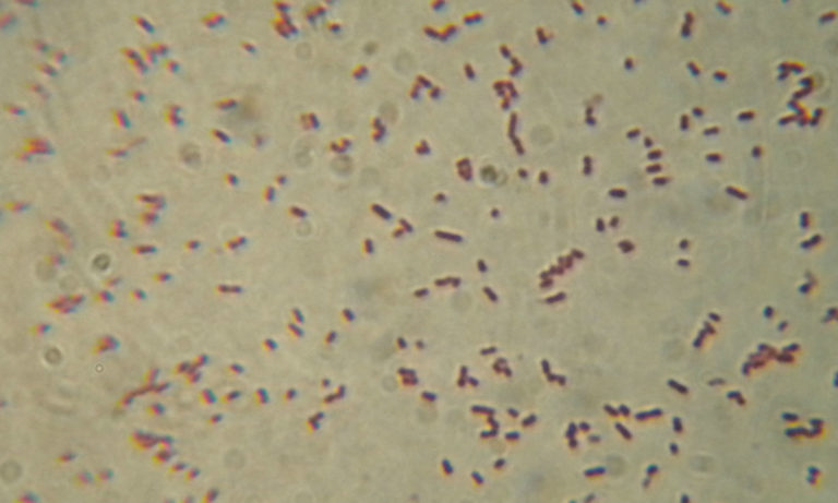 Shigella flexineri – Pure Microbes